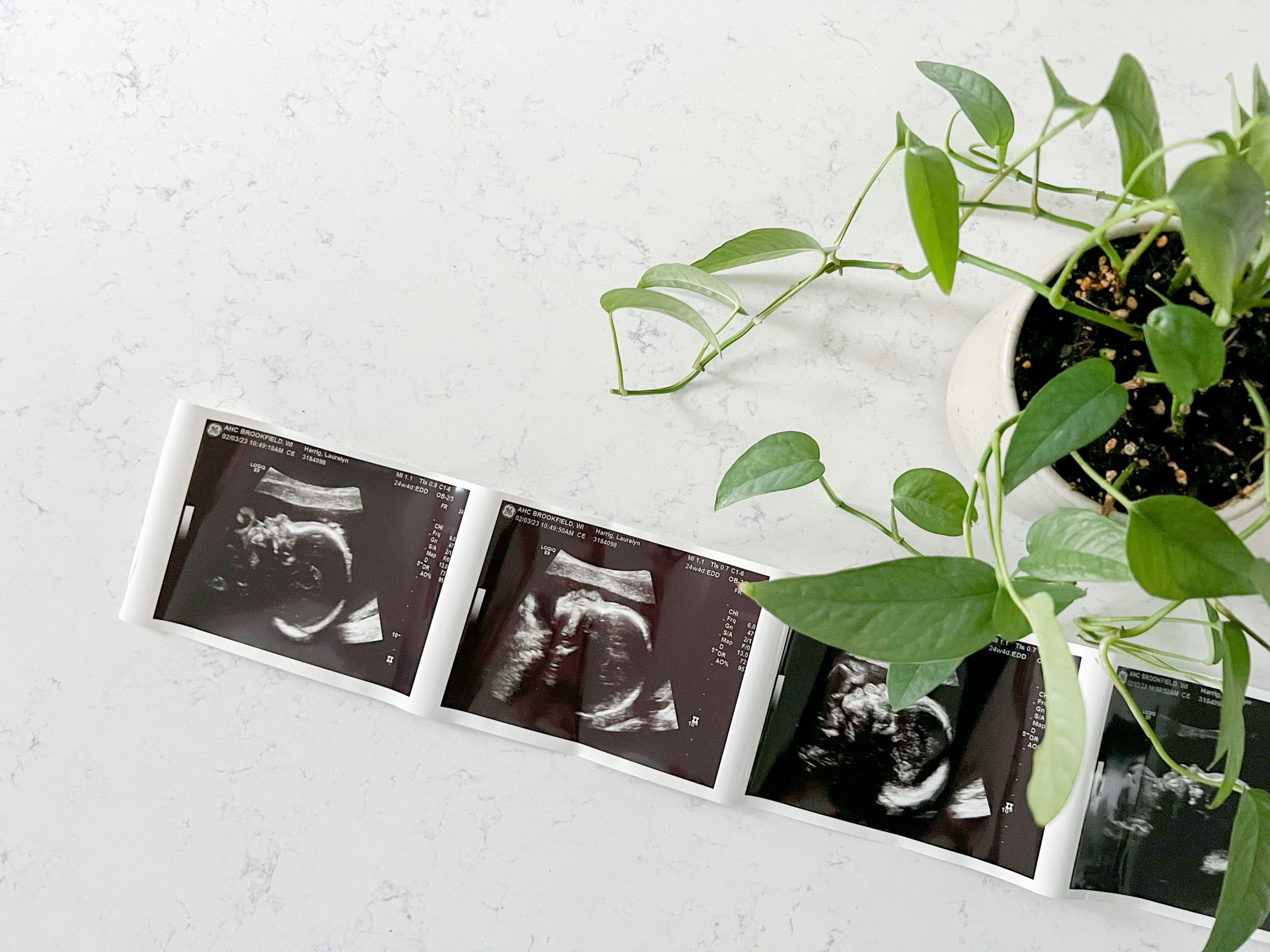 ultrasound sonogram image to announce pregnancy for woman business owner, a brand photographer